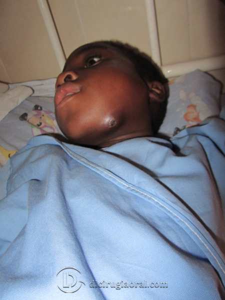 voluntariado odontológico en Camerún