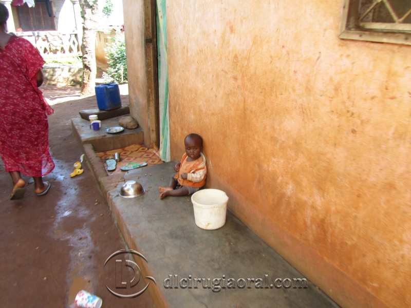 voluntariado odontológico en Camerún