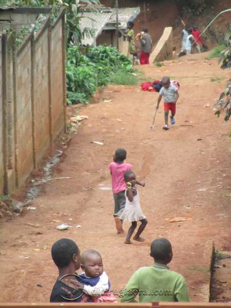 voluntariado odontológico en Camerún