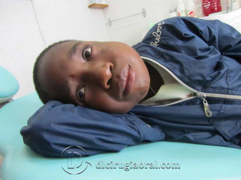 voluntariado odontológico en Camerún