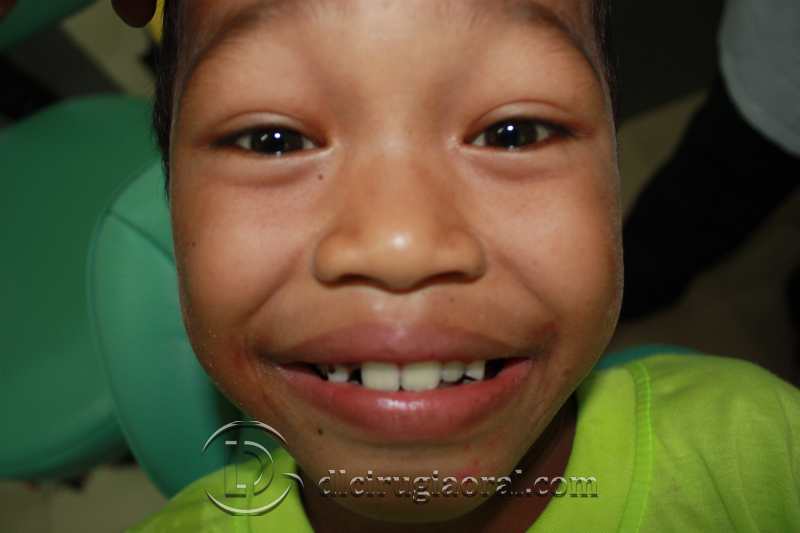 ONG Por la Sonrisa de un Niño