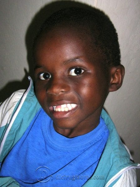 voluntariado odontológico Mozambique