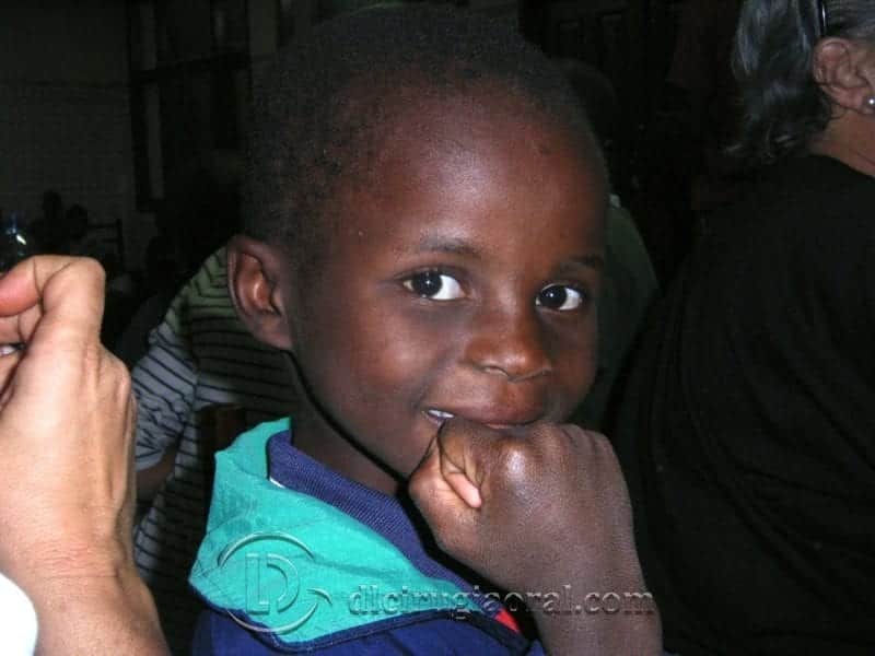 voluntariado odontológico Mozambique