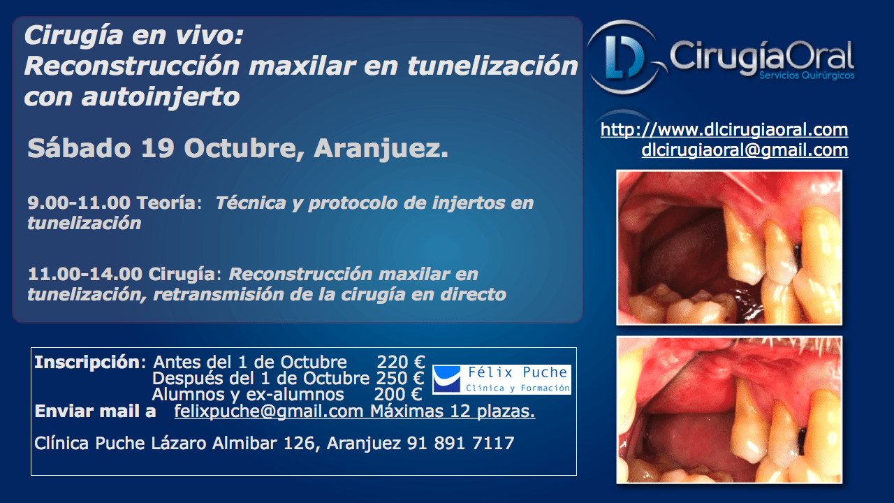 curso sobre reconstrucción maxilar