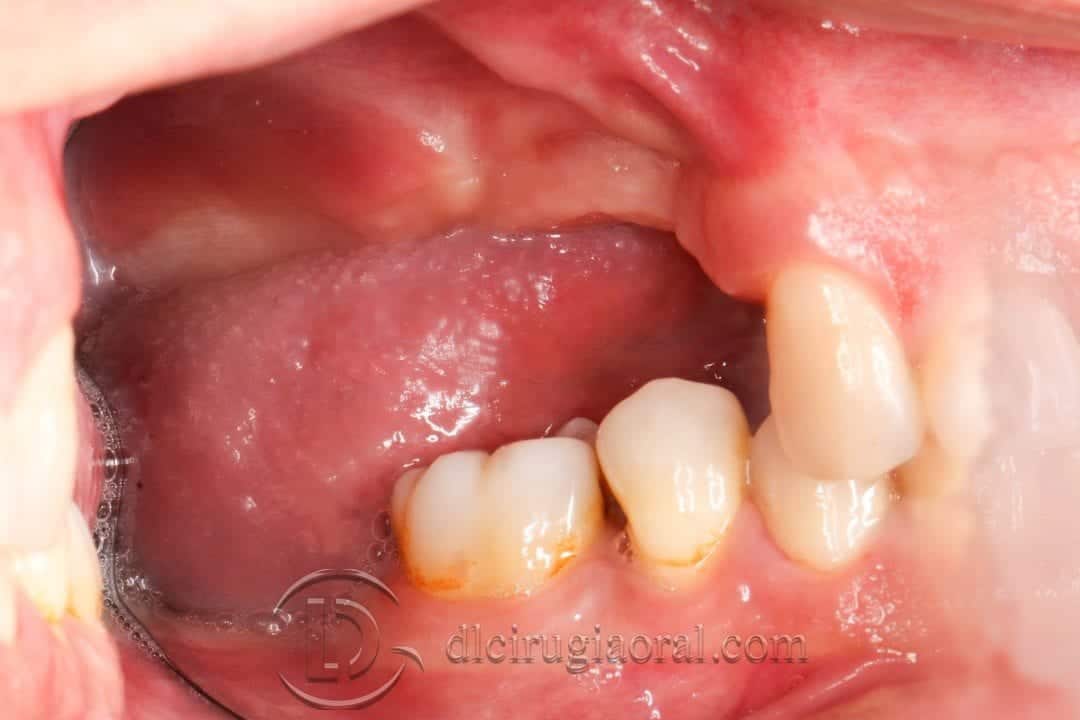 curso de cirugía oral
