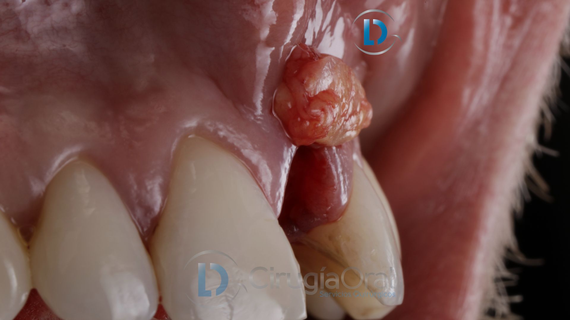Implante dental en sector anterior